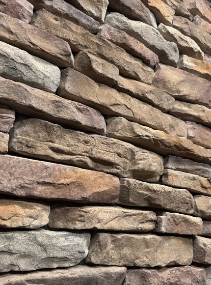 STL: Bucks County - RockSolid Veneers