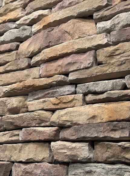 STL: Bucks County - RockSolid Veneers